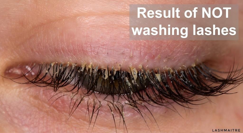 "Macro medical photograph by LASHMAITRE showing biofilm buildup on unwashed lashes, illustrating the hygiene risks of avoiding water when asking 'can i get my eyelash extensions wet'."