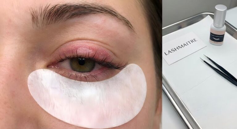 Close-up photo of a LASHMAITRE client's eye showing significant redness and swelling on the eyelid, illustrative of severe eyelash extension allergic reaction symptoms, alongside a tray with professional adhesive and tools.